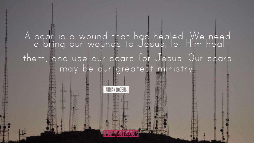 Adrian Rogers Quotes: A scar is a wound