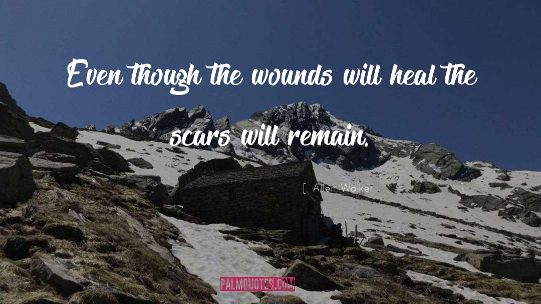 Allen Walker Quotes: Even though the wounds will