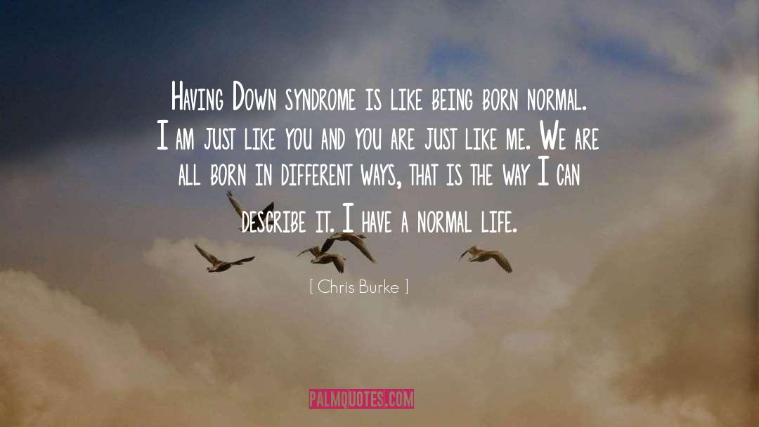 Chris Burke Quotes: Having Down syndrome is like