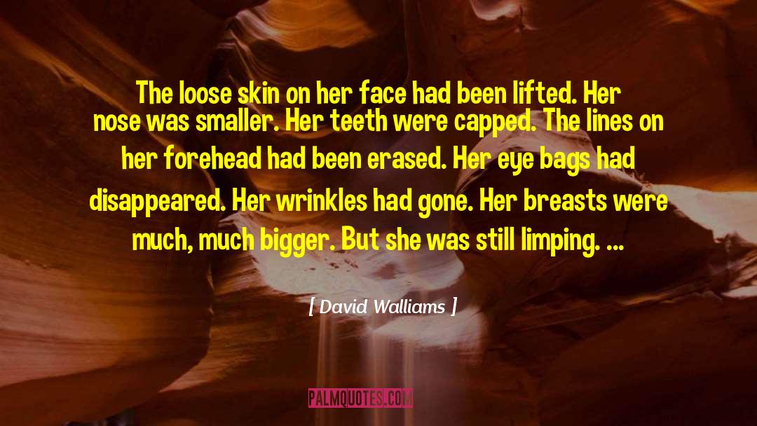 David Walliams Quotes: The loose skin on her