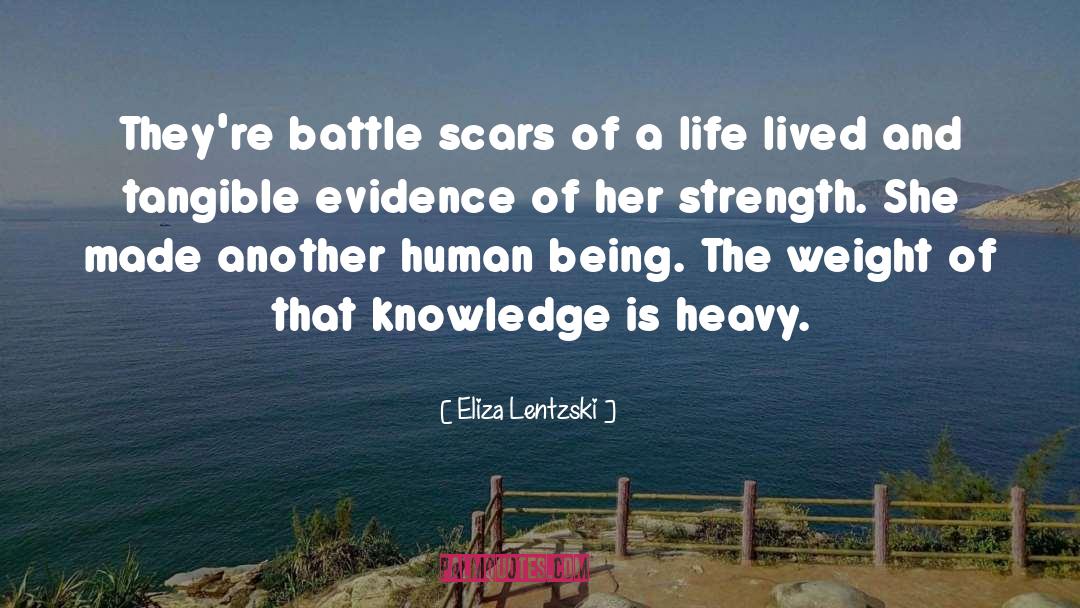 Eliza Lentzski Quotes: They're battle scars of a