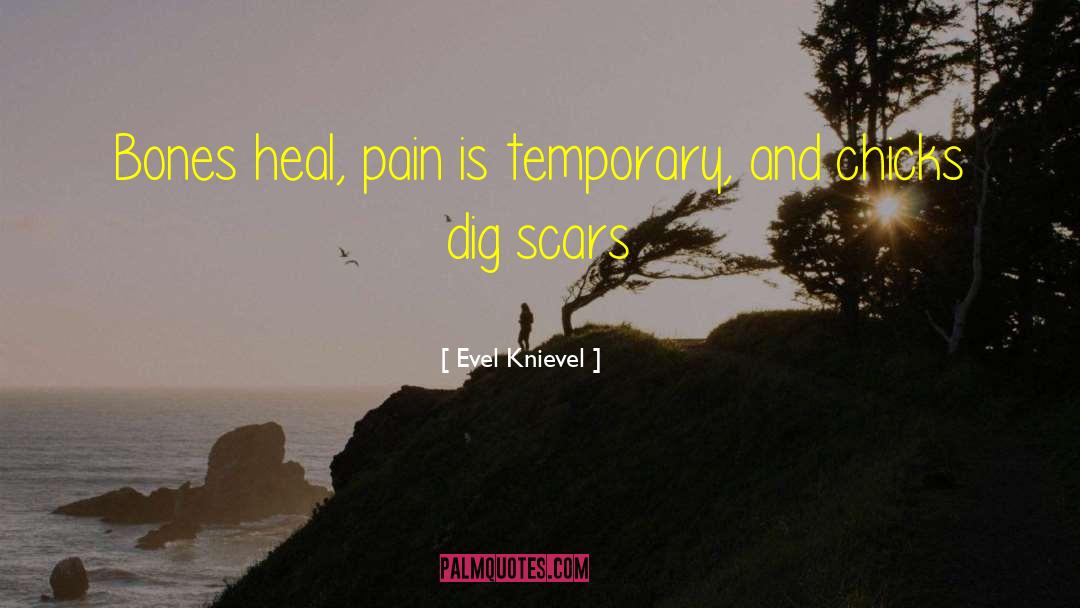 Evel Knievel Quotes: Bones heal, pain is temporary,