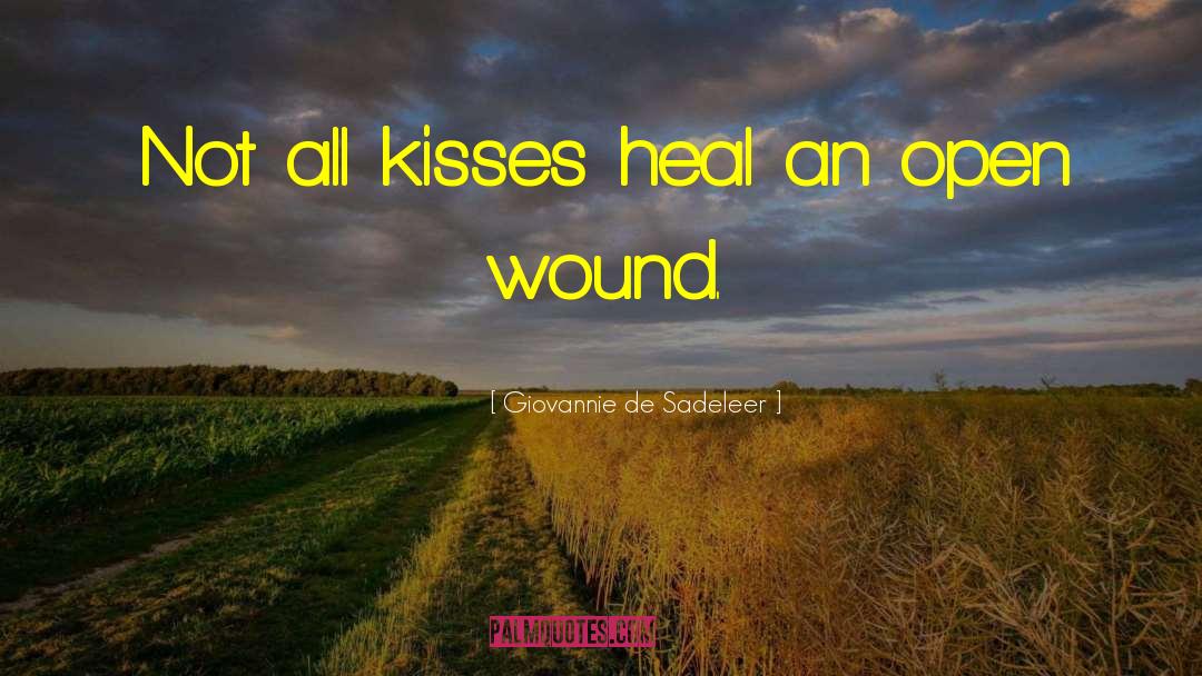 Giovannie De Sadeleer Quotes: Not all kisses heal an