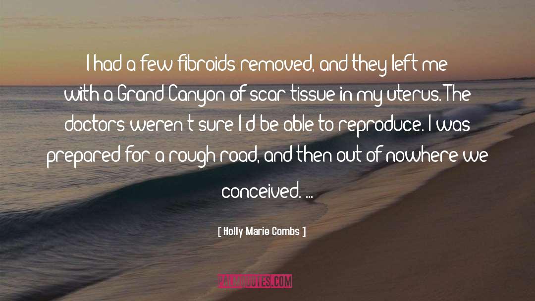 Holly Marie Combs Quotes: I had a few fibroids