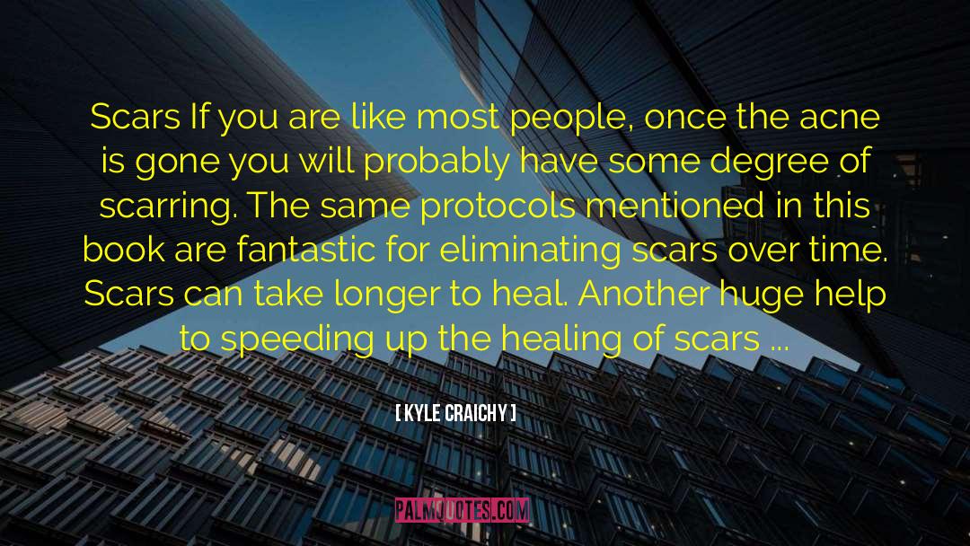 Kyle Craichy Quotes: Scars If you are like