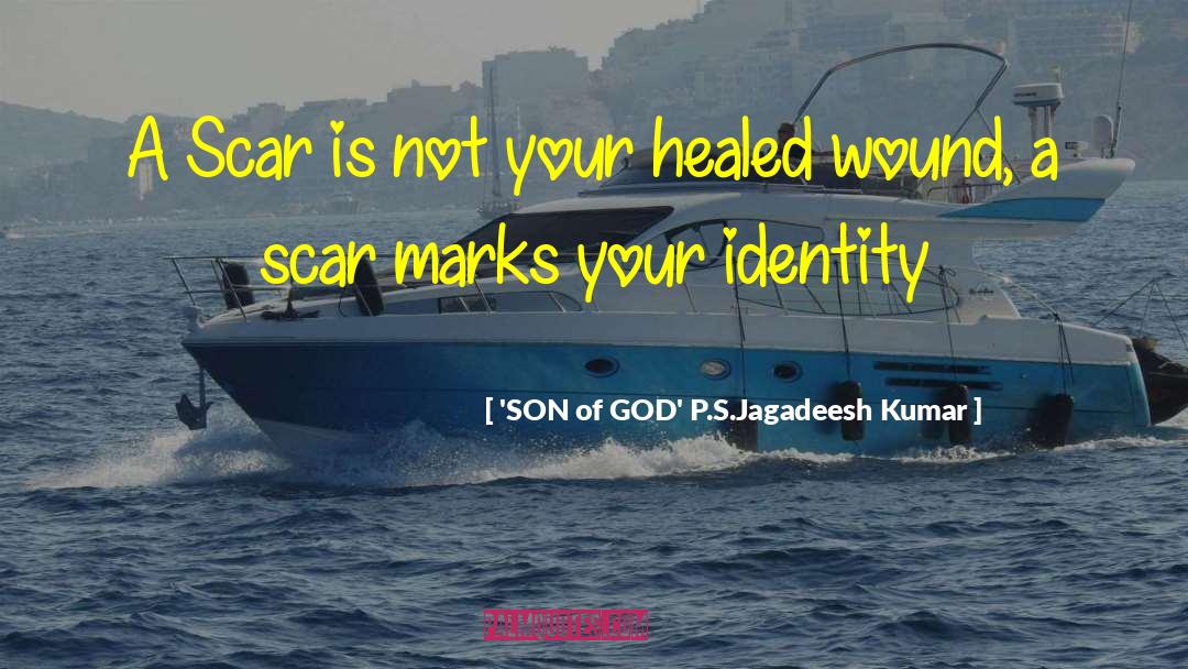 'SON Of GOD' P.S.Jagadeesh Kumar Quotes: A Scar is not your