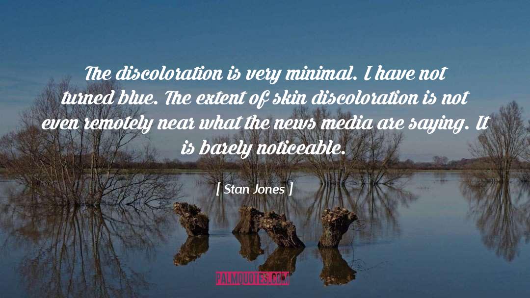 Stan Jones Quotes: The discoloration is very minimal.