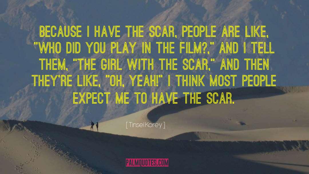 Tinsel Korey Quotes: Because I have the scar,