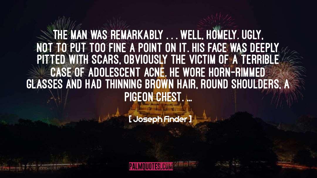 Acne quotes by Joseph Finder
