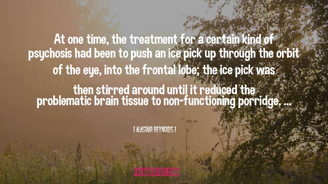 Blepharoplasty Eye Treatment quotes by Alastair Reynolds