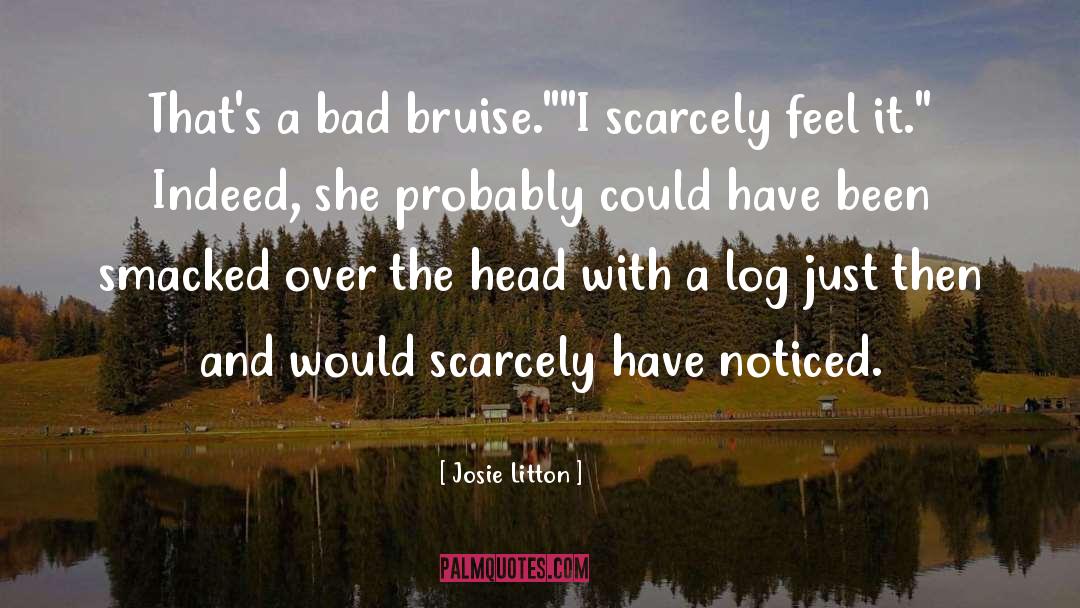 Bruise quotes by Josie Litton