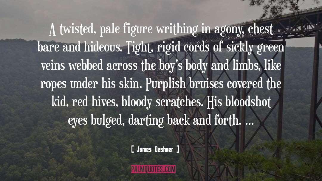 Bruises quotes by James Dashner