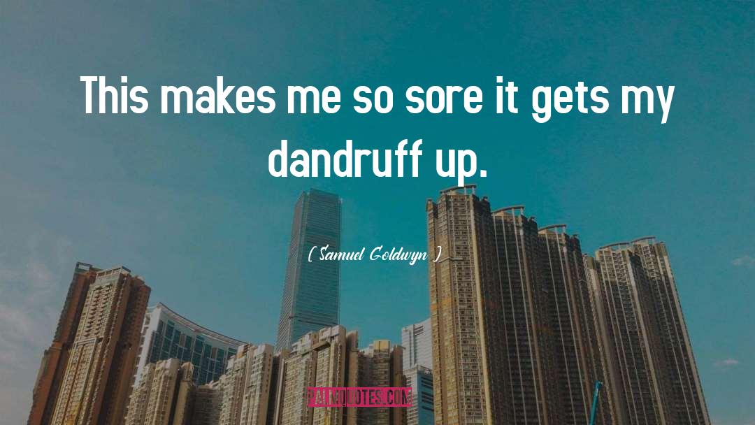 Dandruff quotes by Samuel Goldwyn