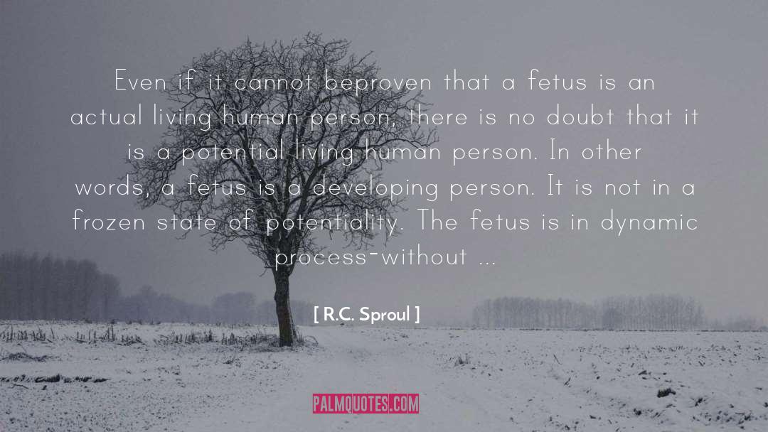 Fetus quotes by R.C. Sproul