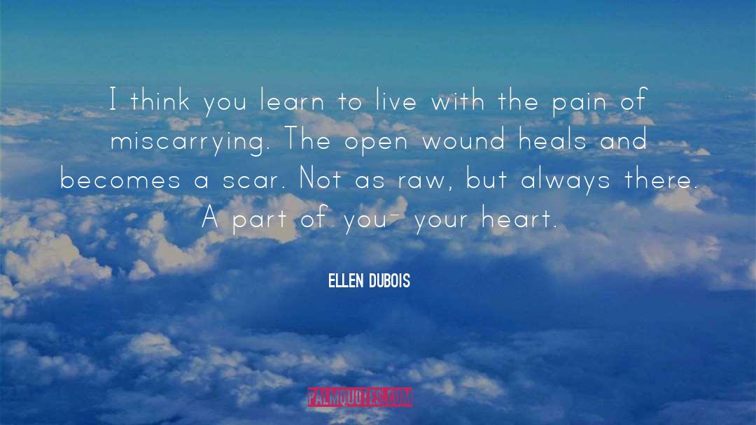 Heart Pain quotes by Ellen DuBois