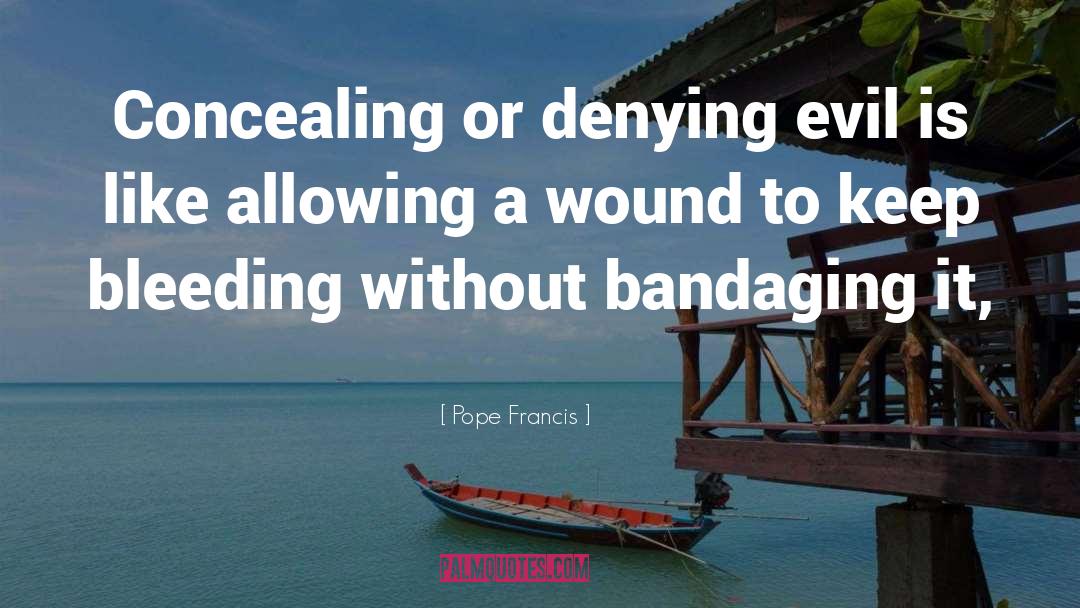 Outshoot Wound quotes by Pope Francis