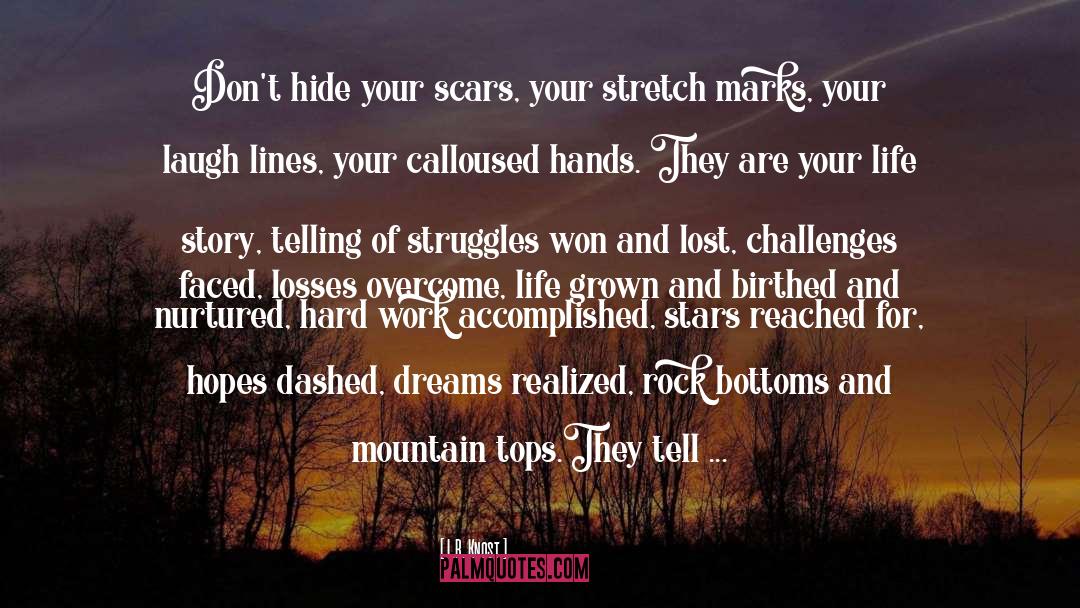 Scars quotes by L.R. Knost