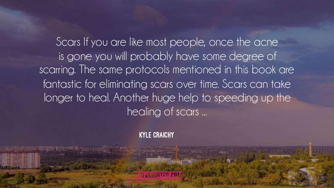 Scars quotes by Kyle Craichy