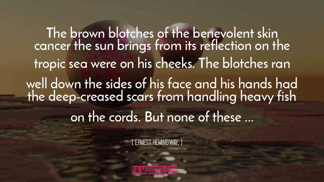Skin Cancer quotes by Ernest Hemingway,