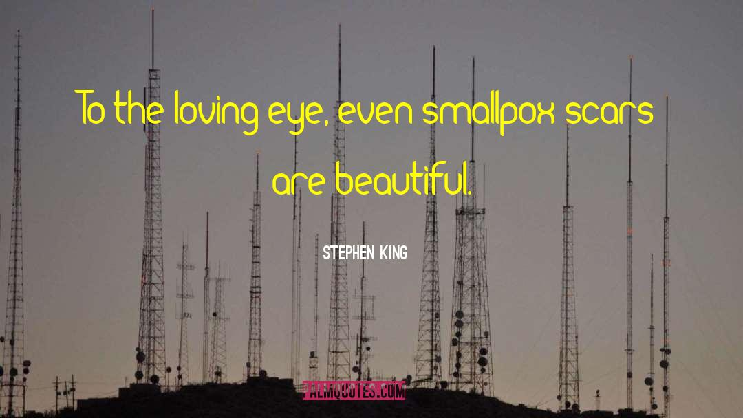 Smallpox quotes by Stephen King