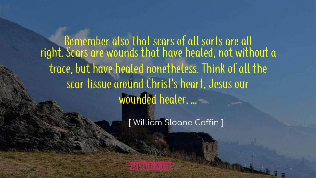 The Scar quotes by William Sloane Coffin