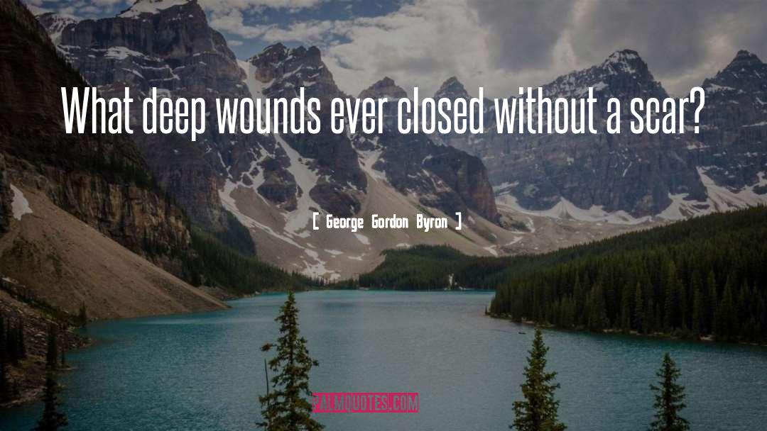 Wounds And Scars quotes by George Gordon Byron